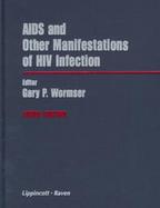 AIDS and Other Manifestations of HIV Infection cover