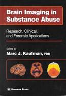 Brain Imaging in Substance Abuse Research, Clinical, and Forensic Applications cover