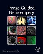 Image-Guided Neurosurgery cover