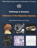 World Health Organization Classification of Tumours Pathology and Genetics of Tumours of the Digestive System cover