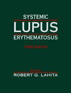 Systemic Lupus Erythematosus cover