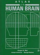 Atlas of the Human Brain cover