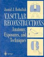 Vascular Reconstructions Anatomy, Exposures, and Techniques cover