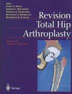 Revision Total Hip Arthroplasty cover