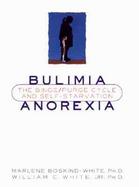 Bulimia/Anorexia: The Binge/Purge Cycle and Self-Starvation cover