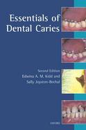 Essentials of Dental Caries The Disease and Its Management cover