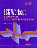 Ecg Workout: Exercises in Arrhythmia Interpretation cover