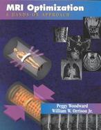 MRI Optimization: A Hands-On Approach cover