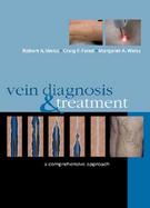 Vein Diagnosis and Treatment A Comprehensive Approach cover