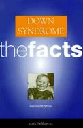 Down Syndrome The Facts cover