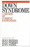 Down Syndrome A Review of Current Knowledge cover
