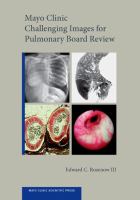 Mayo Clinic Challenging Images for Pulmonary Board Review cover