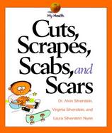 Cuts, Scrapes, Scabs, and Scars cover