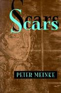Scars cover