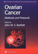 Ovarian Cancer Methods and Protocols cover