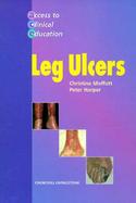 Leg Ulcers cover
