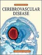 Principles of Cerebrovascular Disease cover