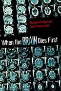 When the Brain Dies First cover