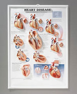 Heart Disease Raised Relief cover