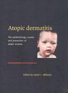Atopic Dermatitis The Epidemiology, Causes and Prevention of Atopic Eczema cover