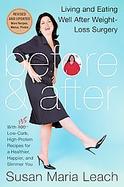 Before , &,  After, Revised Edition: Living and Eating Well After Weight-Loss Surgery cover