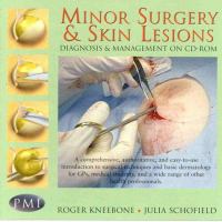 Minor Surgery & Skin Lesions: Diagnosis & Management with Book cover