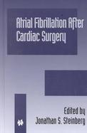 Atrial Fibrillation After Cardiac Surgery cover
