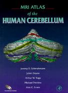 Mri Atlas of the Human Cerebellum cover