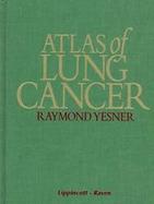 Atlas of Lung Cancer cover