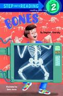 Bones cover