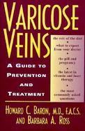Varicose Veins: A Guide to Prevention and Treatment cover