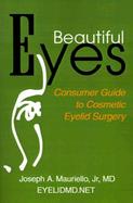 Beautiful Eyes Consumer's Guide To Cosmetic Eyelid Surgery cover