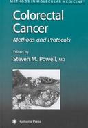 Colorectal Cancer Methods and Protocols Methods and Protocols cover