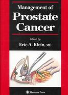 Management of Prostate Cancer cover