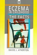 Eczema in Childhood: The Facts cover