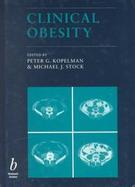 Clinical Obesity cover