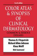 Color Atlas and Synopsis of Clinical Dermatology Common and Serious Diseases cover