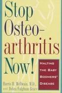 Stop Osteoarthritis Now!: Halting the Baby Boomers' Disease cover