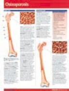 Osteoporosis Chart-Single Panel Chart cover
